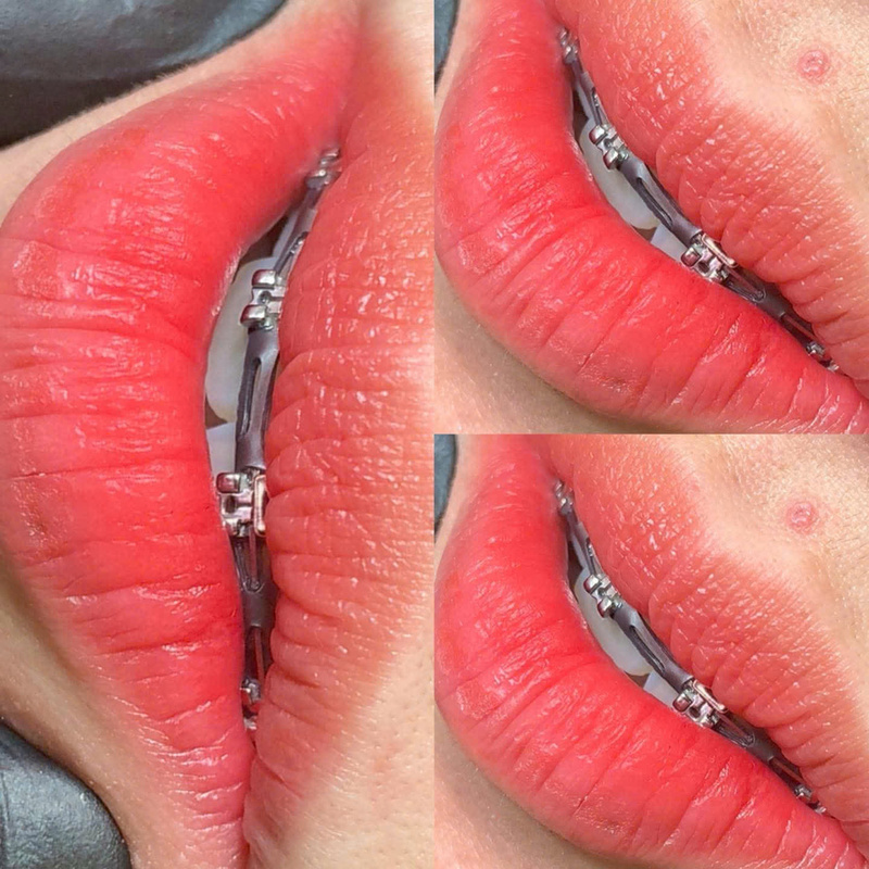 Phun môi collagen 